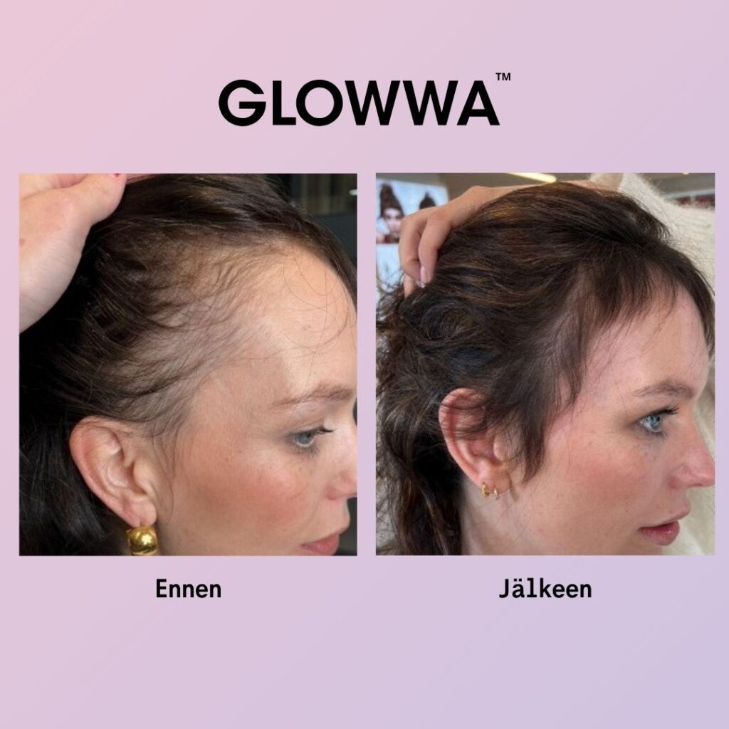 ennen ja jälkeen kuva kun glowwa ravintolisää on käytetty.